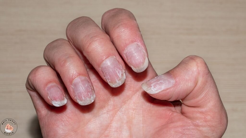 “How to repair damaged nails from biting with nail care tips for rough, bitten nails and cuticle repair”